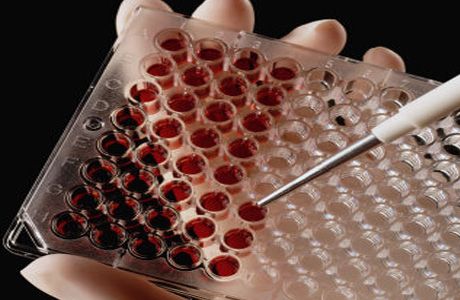 HIV:n heteroseksuaalinen tarttuminen: uusia löydöksiä
