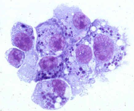 Ihmisen anaplasmoosin patogeenit (Anaplasmataceae-perhe)