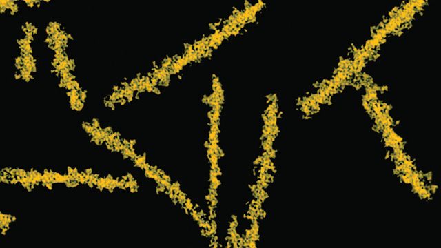Prionit - prionitautien aiheuttajat