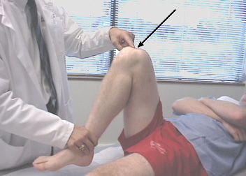 Polven taivutuksessa esiintyvä kipu on yleisin syy, miksi ihmiset käyvät traumatologilla.