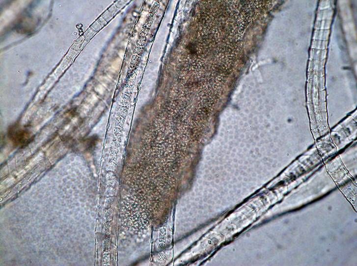 Epidermofytoosipatogeenit